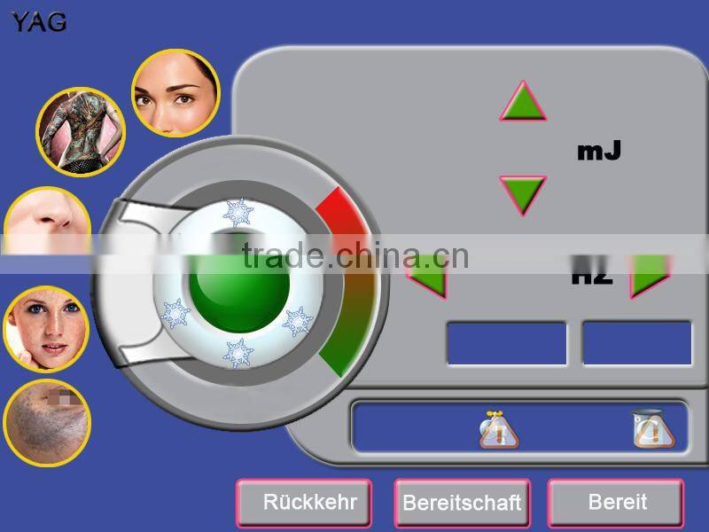 Best nd yag laser tattoo removal machine with high quality