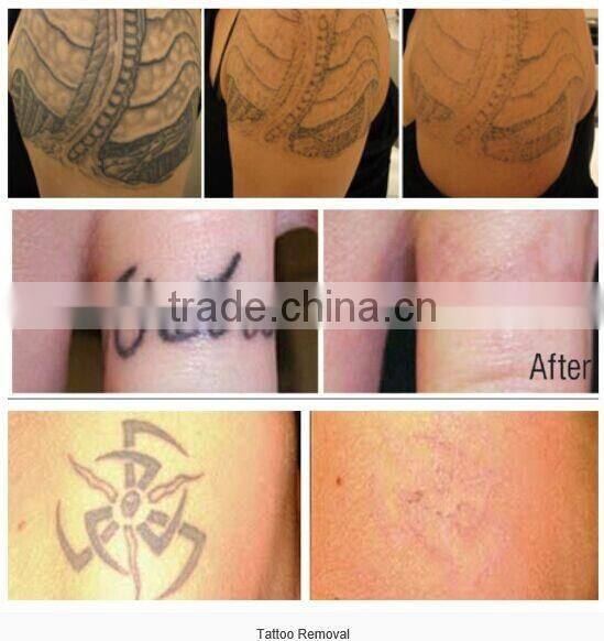 Microneedles for skin care, Derma Roller titanium needles