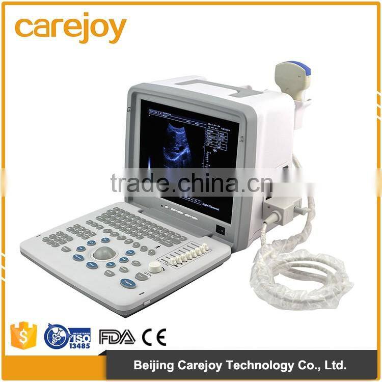 Lowe Price Medical Equipment Portable Cheap ultrasound Scanner/Machine 3.5Mhz multi-frequency Convex Probe