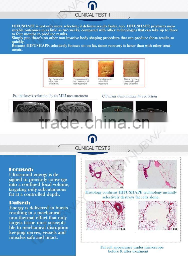 Vertical type HIFU / HIFU slimming machine / cavitation slimming machine