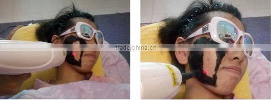 ipl rf machine / multifunctional beauty equipment / nd yag laser ipl rf e light 4 in 1 equipment