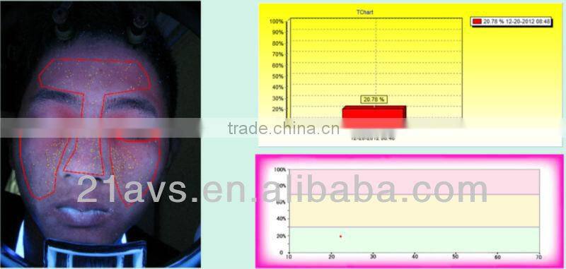 Professional Facial Skin Analyzer Magic Mirror with software system for beauty salon