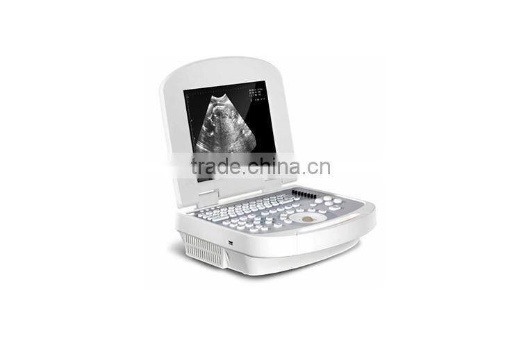 China beijing 10.7 inch color LCD 2B Ultrasound Imaging System laptop ultrasound scanner with CE ISO Approved