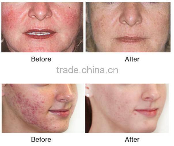 M801 Best Sale Top Sell House Use High Frequency Professinal 8in1 Multifunctional Instrument Beauty Machine