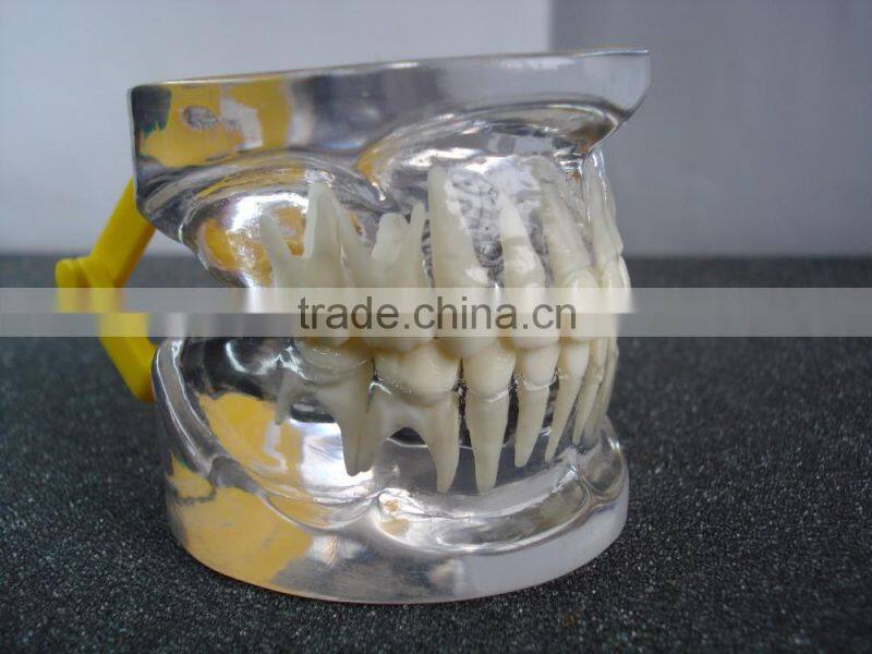 Transparant deciduous Teeth Model Teaching And Hospital Demonstration