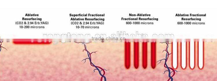 fractional laser co2 tga approval medical beautiful supplies med-870+