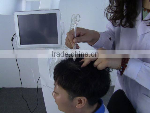 Top Sale 650nm Diode Laser Best Hair Regrowth Machine