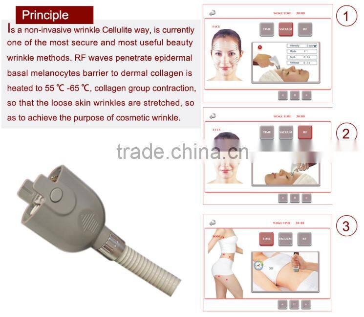 RF Wrinkle Removal Skin smooth slimming Beauty Machine