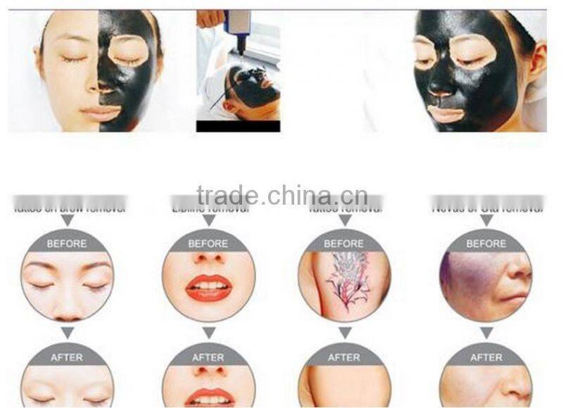 AYJ-302B ayplus 2016 best laser tattoo removal machine