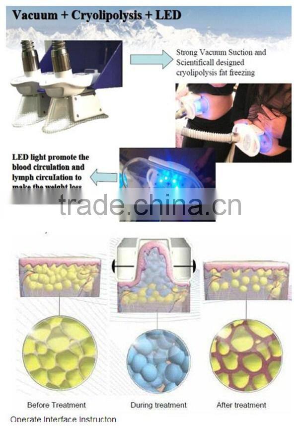 Mini Vacuum and RF Beauty Salon Equipment