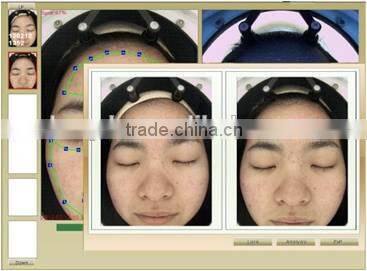 CE Approval 1 years warranty magic mirror facial skin analyzer