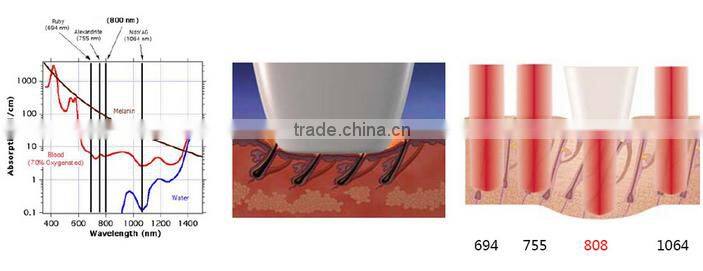 bestseller professional 808 depilation laser hair removal/ professional 808nm diode laser hair removal device