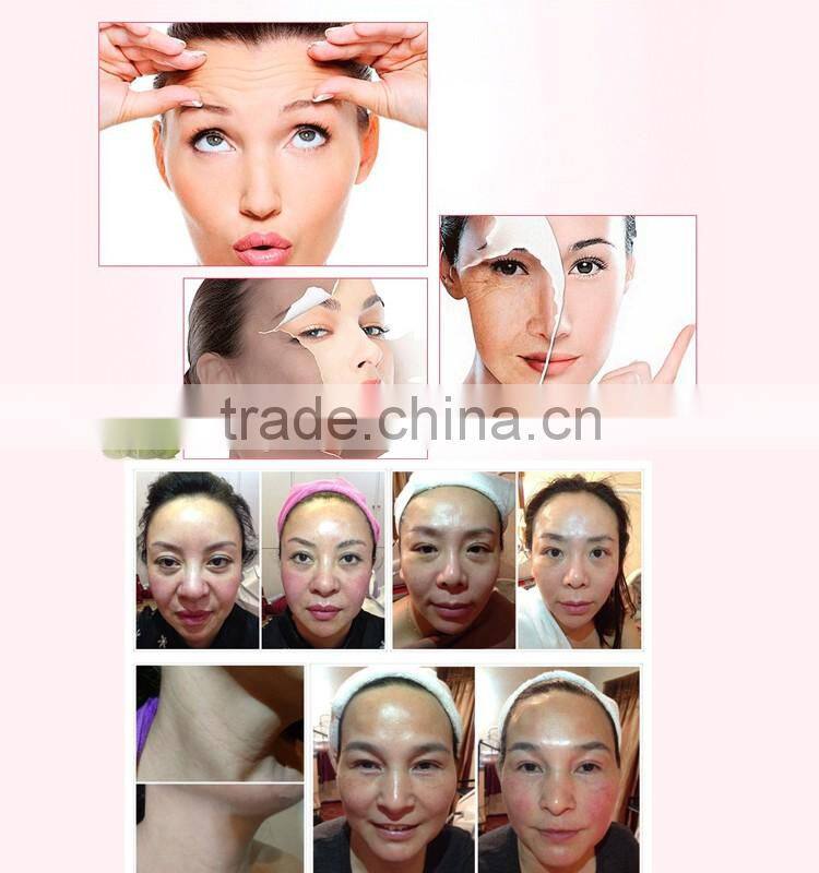 New Product Skin Tightening hifu slimming