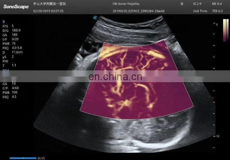 Competitive hospital medical equipment trolley Sonoscape 4d /Ultrasound scanner /Sonoscape S50 Elite