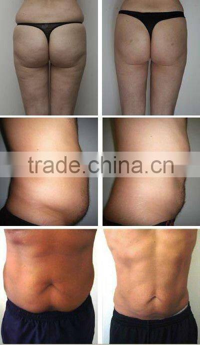 protable 650nm laser/diode laser machine/laser slimming machine