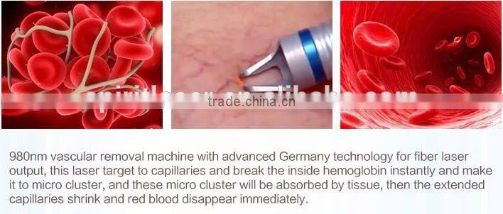 Spiritlaser fda approved diode laser equipment 980nm diode laser Vascular Removal Laser Treatment