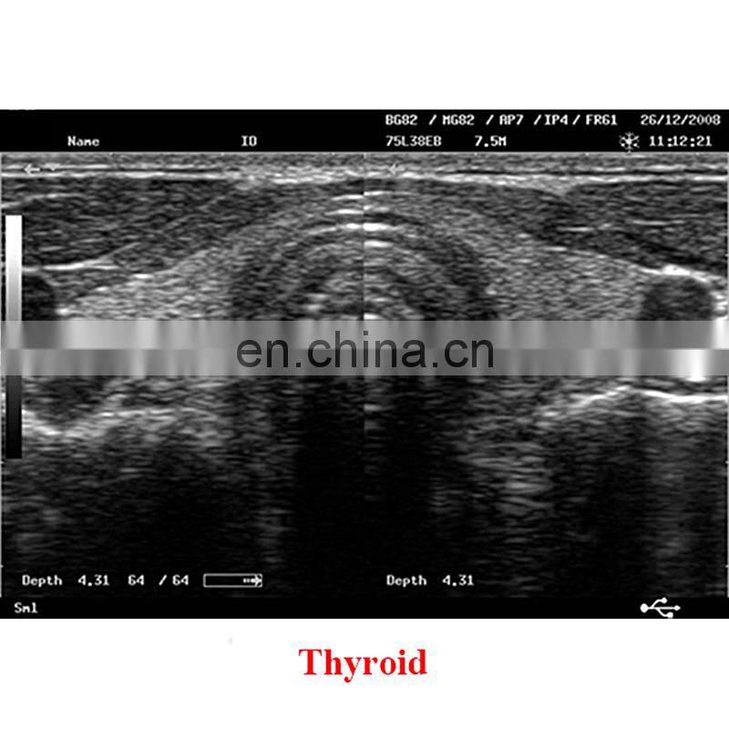 Hot Sales Original Mindray DP-2200PLUS Portable Full digital ultrasound machine /mindary ultrasound