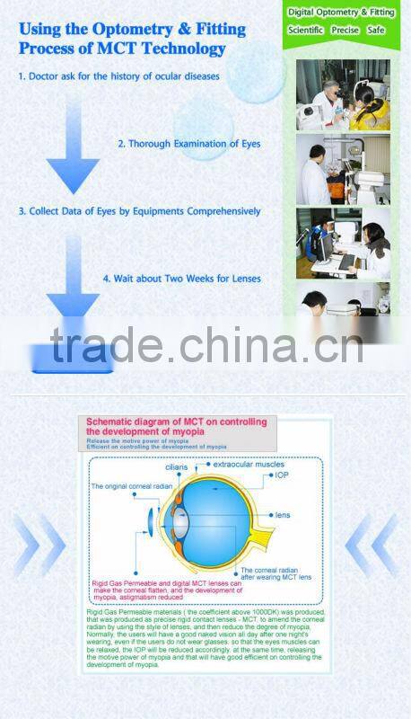 MCT Hard lens For low myopia/MCT lenses/no operation treat myopia,make your eyes normal