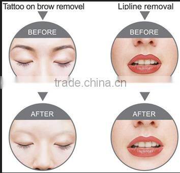 E6 1064nm 532nm lengthwave IPL/ nd yag laser hair removal & tattoo removal