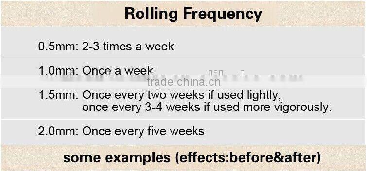 CE approval dermaroller 180 titanium microneedle derma skin roller