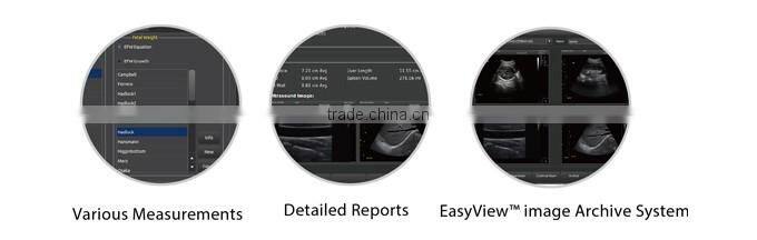Top quality imaging cheapest BW Chison ECO2 portable ultrasound price