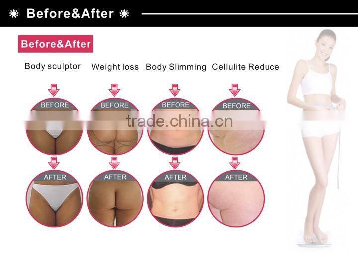 Ultrasonic Cavitation RF Skin regeneration radio frequency machine with CE---SINERON-II