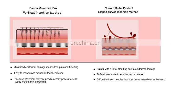 Pin needle cartridge replacement micro needles head stainless steel tattoo needles for dr derma pen tattoo tips