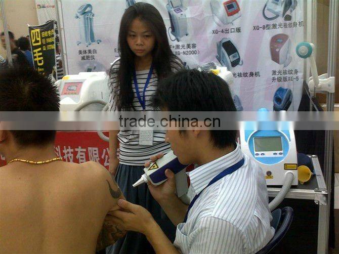 (2013 Hot sales) MINI pigment removal tattoo removal laser machine OB-TR 03