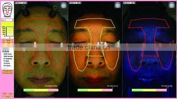 WT-03-B Big Facial Skin Analyzer Magic Mirror