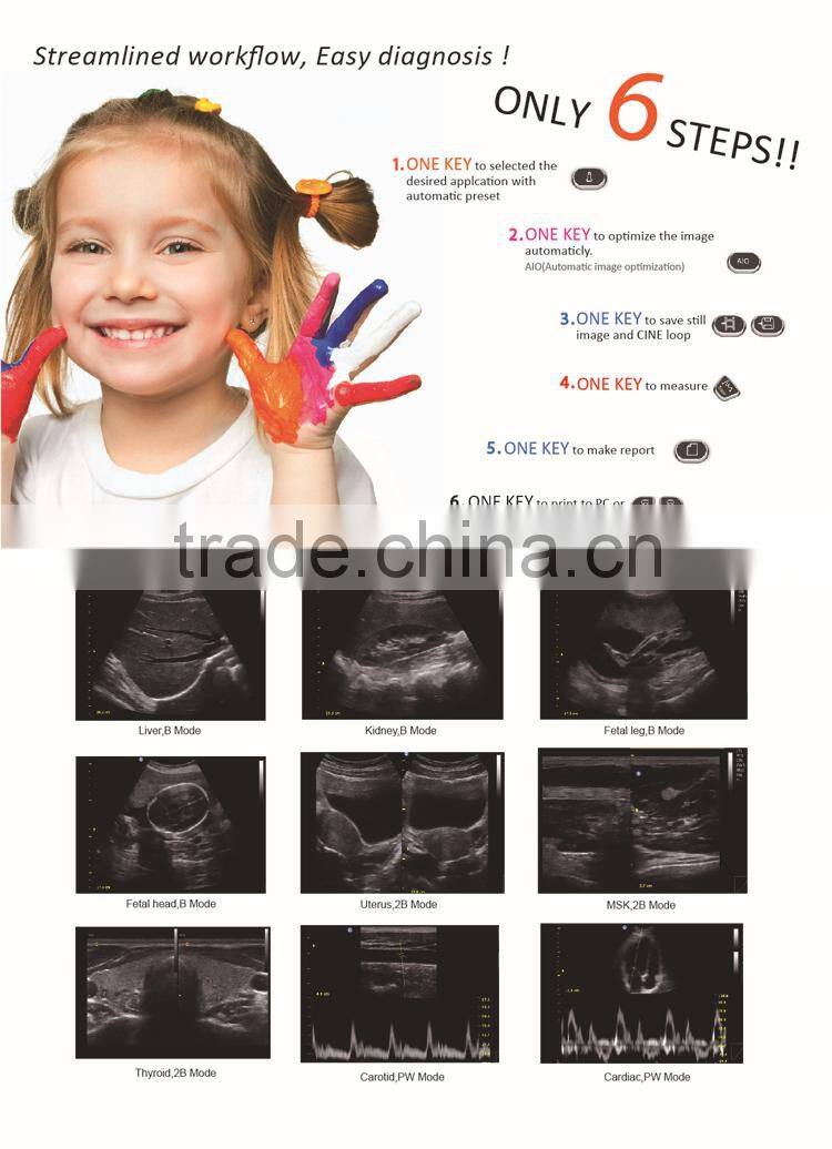 3d/4d Ultrasound Scanner