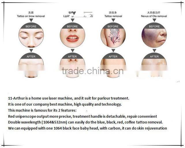 K11 laser tattoo removal/eyebrow removal/eyeline removal machine