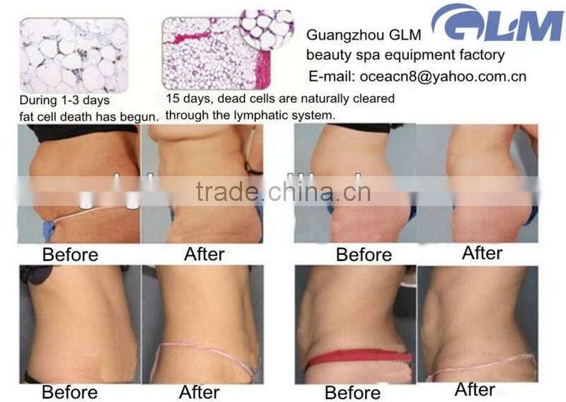 4 in 1 fat freezing rf 40K cavitation weight loss machine with CE