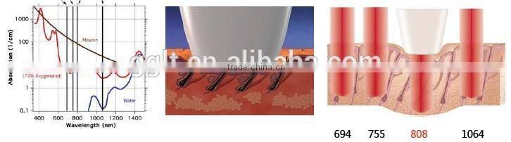 2015 free shipping 808nm diode laser hair removal device