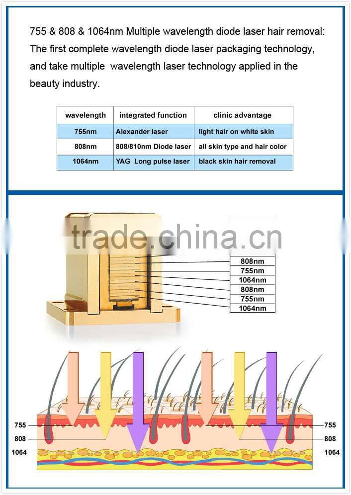 CE approved best quality diode laser hair removal 808nm