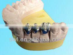 high quality laser spot soldering machine for repair dental Superwave Laser electric welding machine portable