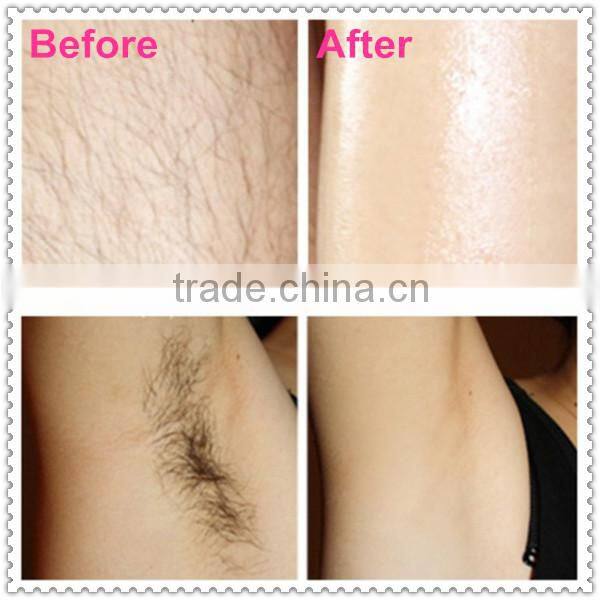 Very popular OPT SHR hair removal machine