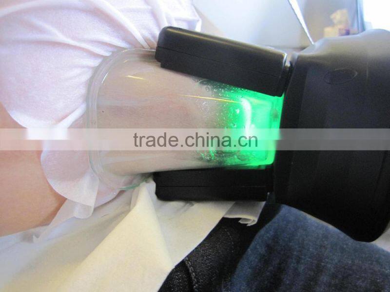guangzhou BL CE approved smart cryolipolysis fat freezing machine
