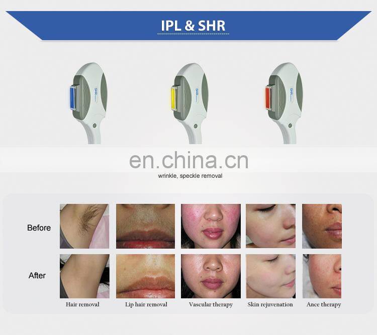 Professional IPL Hair Removal Laser SHR IPL Permanent Hair Removal Machine