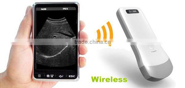 Mobile phone type ultrasound scanner