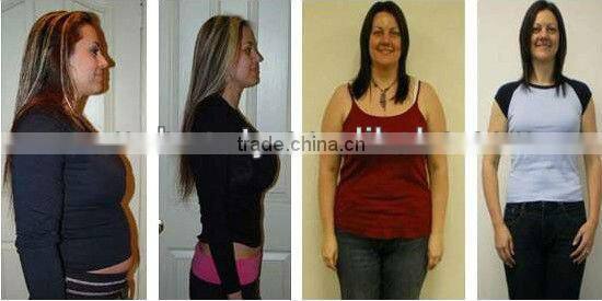 2013 cellulite treatment ultrasonic cavitation slimming machine with RF for men and women