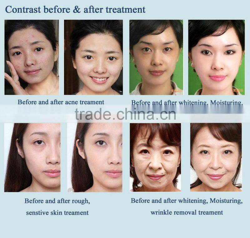 Water Mesotherapy injection machine