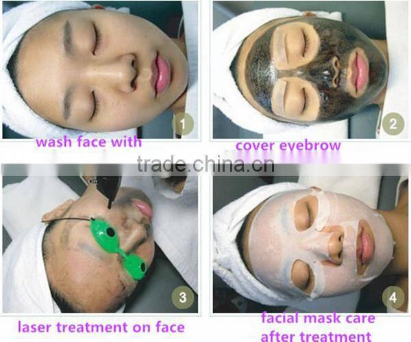 nd yag laser with black tip for skin whitening laser carbon treatment
