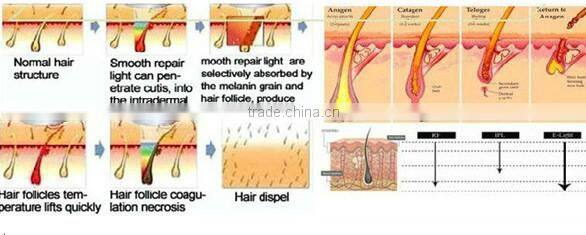 High technology 2 handles multifunctional salon use shr ipl hair removal machine