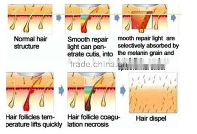 Good Price!! Beauty Device remov tattoo Laser Machine