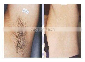 Portable IPL Underarm Hair Removal Machine-A005