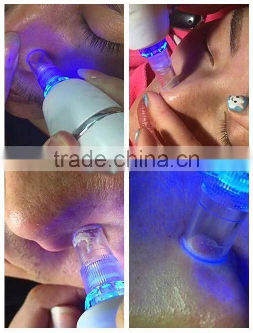 Wholesale price vacuum blackhead remover for home use