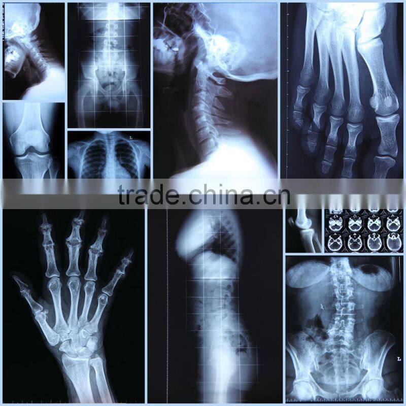 China fuji medical x-ray film KND film with CE