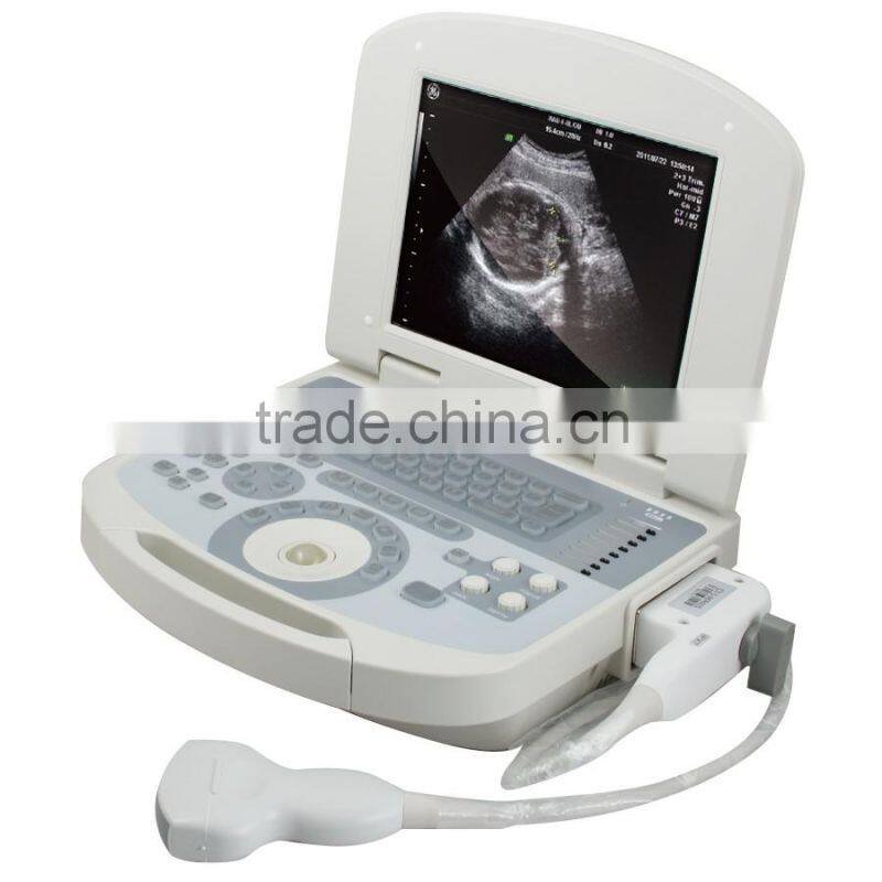 New hot selling portable ultrasound scanner / ultrasound machine suitable clinic community