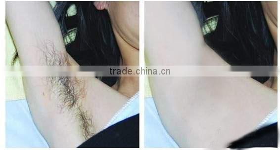 Taibo ODM OEM e-light ipl rf+nd yag laser/E-light +RF +Q-switch nd yag laser tattoo removal hair removal machine 3in1