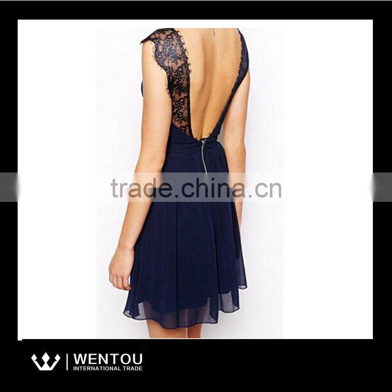 European Style Women Sleeveless Casual Lace Dress